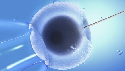 专家